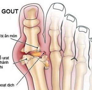 Viên uống The Goutto hỗ trợ Gout - Ảnh 3