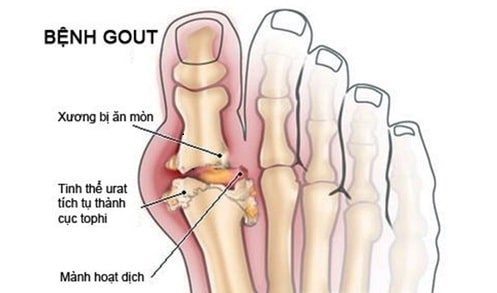 Viên uống The Goutto hỗ trợ Gout - Ảnh 3