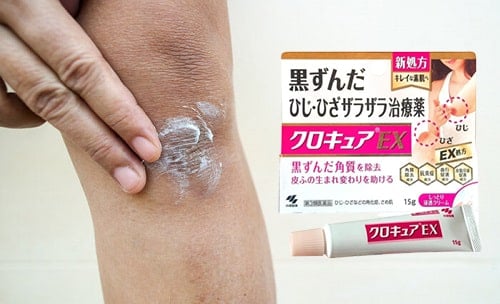 Hãng sản xuất kem trị thâm Kobayashi có tốt không?