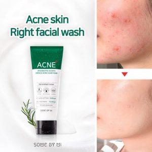 Sữa rửa mặt Some By Mi AHA-BHA-PHA 30 Days Miracle Acne 100ml