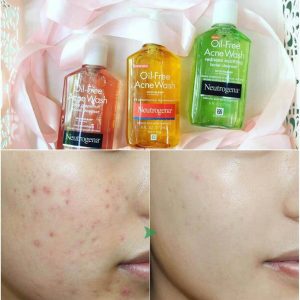 Sữa Rữa Mặt Kiềm Dầu Neutrogena Oil Free Acne Wash 150ml - Ảnh 5