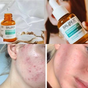 Những câu hỏi thường gặp và lưu ý khi sử dụng Balance Active Formula Niacinamide
