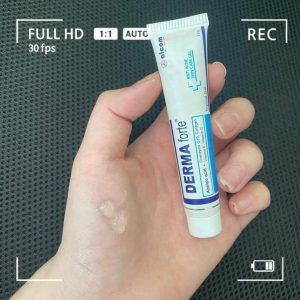 Kem trị mụn A-Derma có tốt không?