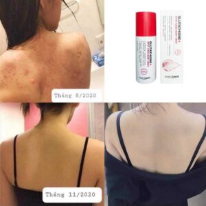 Angel's Liquid Glutathione rv