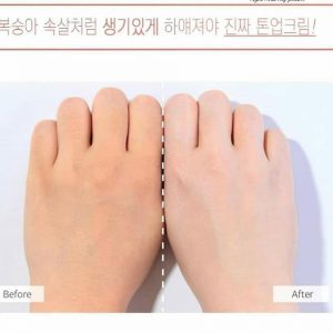 Sur Medic Body REVIEW