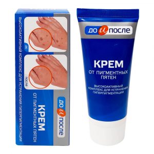 REVIEW kem trị đồi mồi Kpem của Nga có tốt không