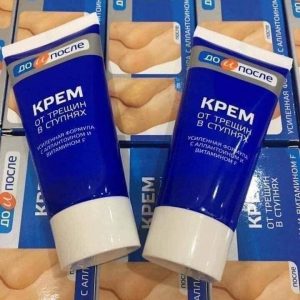 Kpem - kem trị nứt gót chân Nga có tốt không?