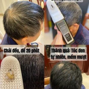 dầu gội thảo dược đen tóc Weilaiya
