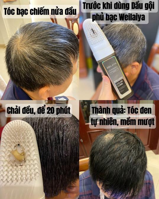 dầu gội thảo dược đen tóc Weilaiya