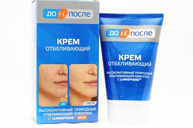 Kem trị nám Kpem của Nga chính hãng 100ml