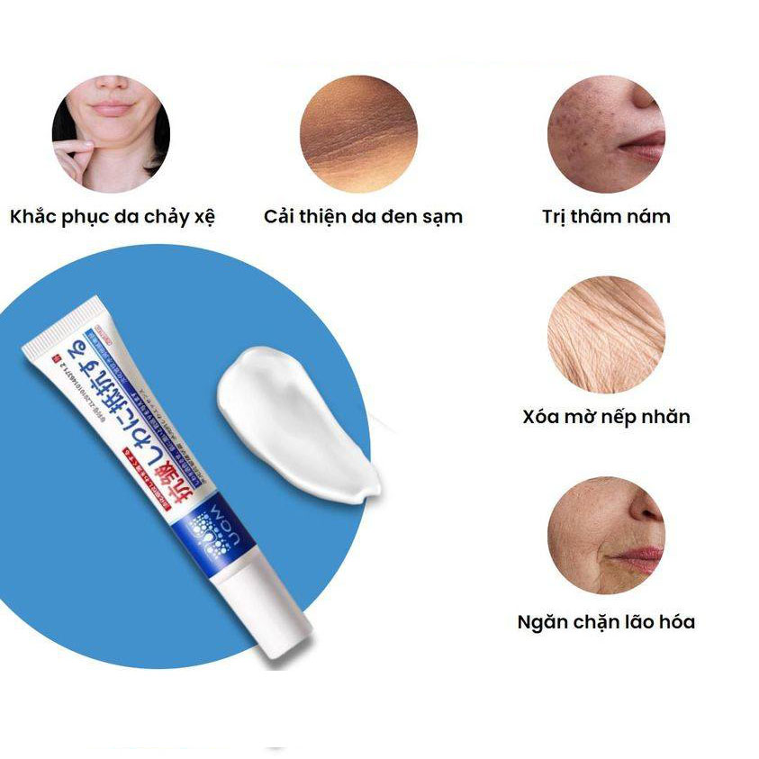 Kem trị nám Nhật Bản UCM có tốt không