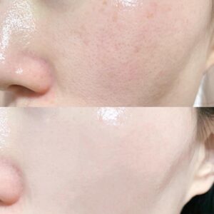 pure retinol high class moist essence cách sử dụng
