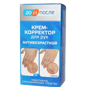 Kem hỗ trợ giảm nhăn, nổi gân tay Kpem Koppektop